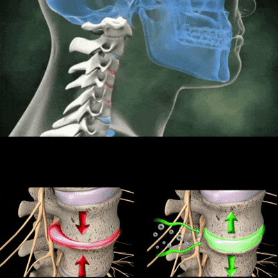 Cervical Traction Pillow