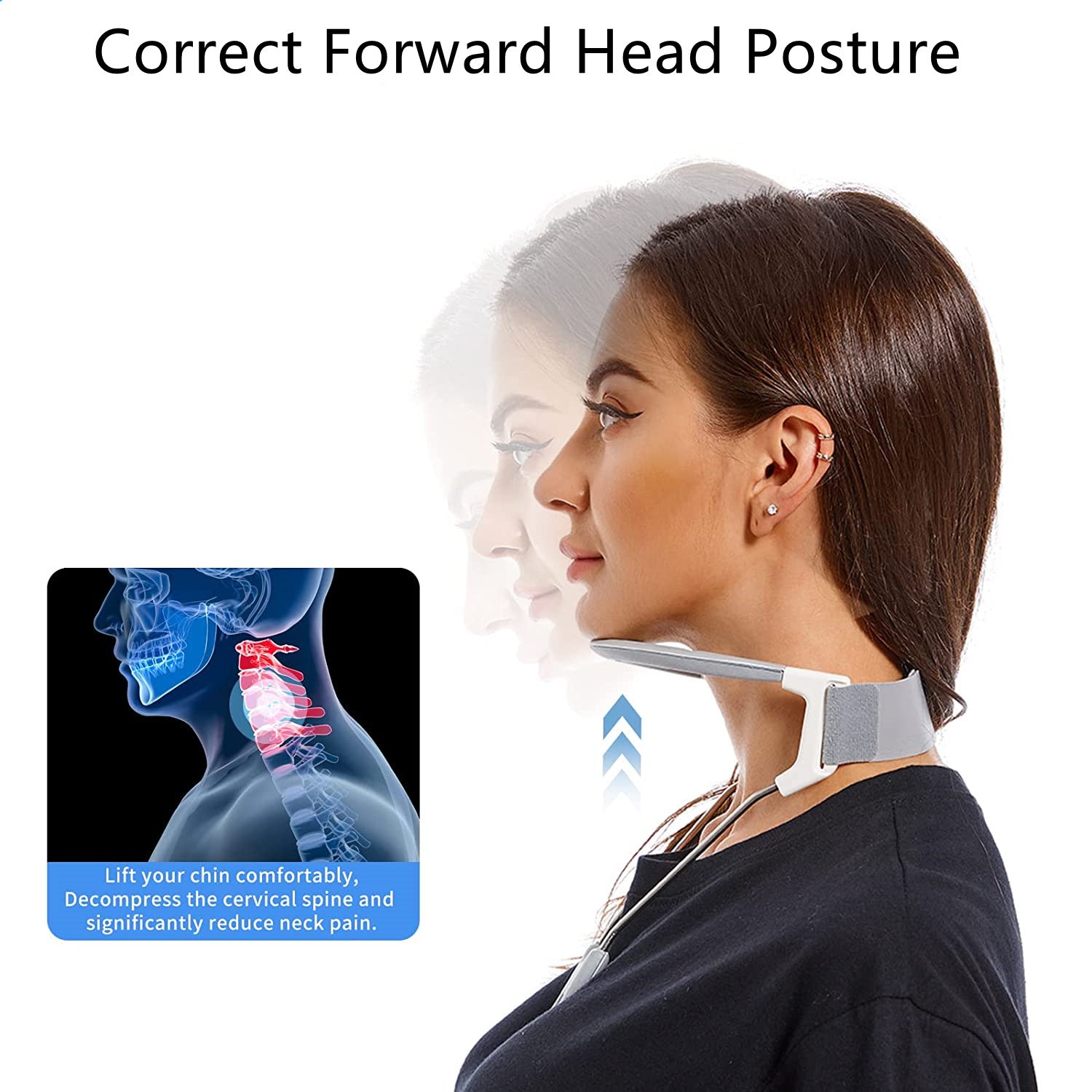 Exploding Collar Forward Head Posture Neck Hump